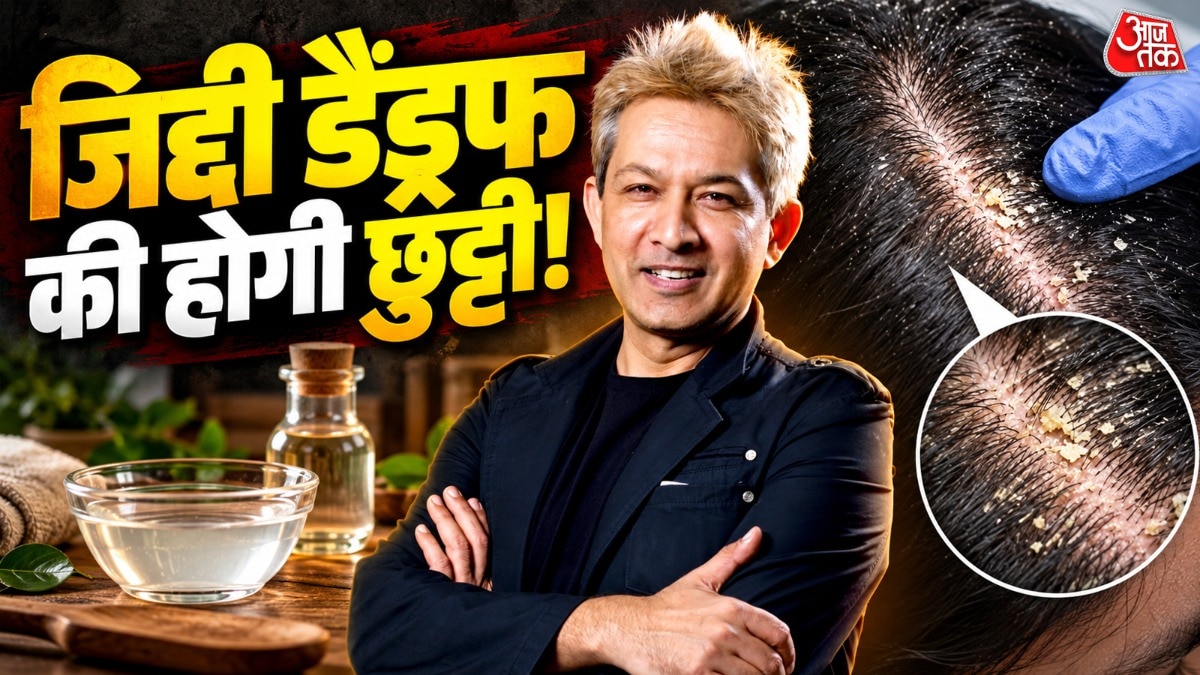 डैंड्रफ से राहत के लिए हेयर एक्सपर्ट का सरल घरेलू उपाय