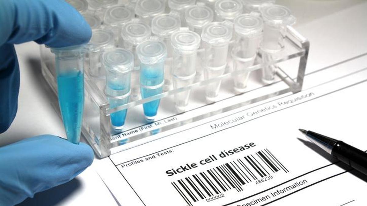 CSIR institute develops India-specific tool for sickle cell severity prediction