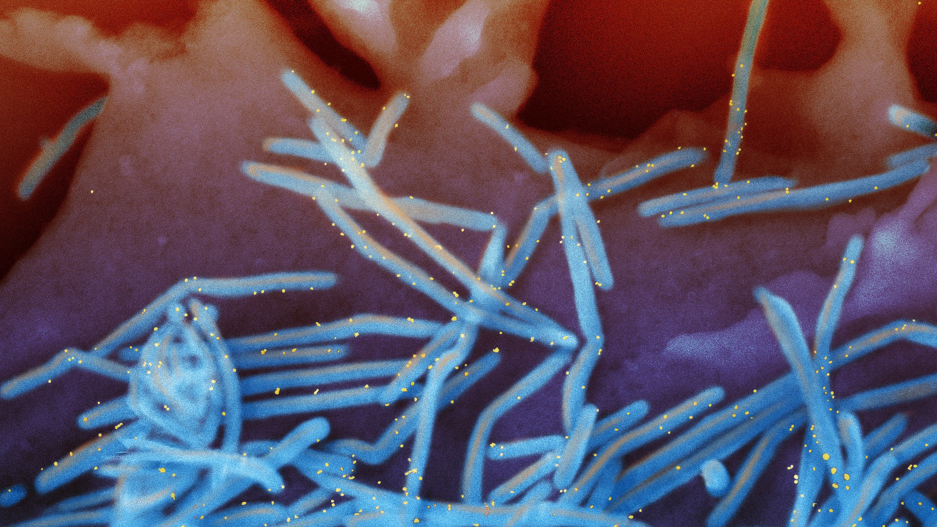 Insurance companies resist covering RSV vaccine for newborns in hospitals