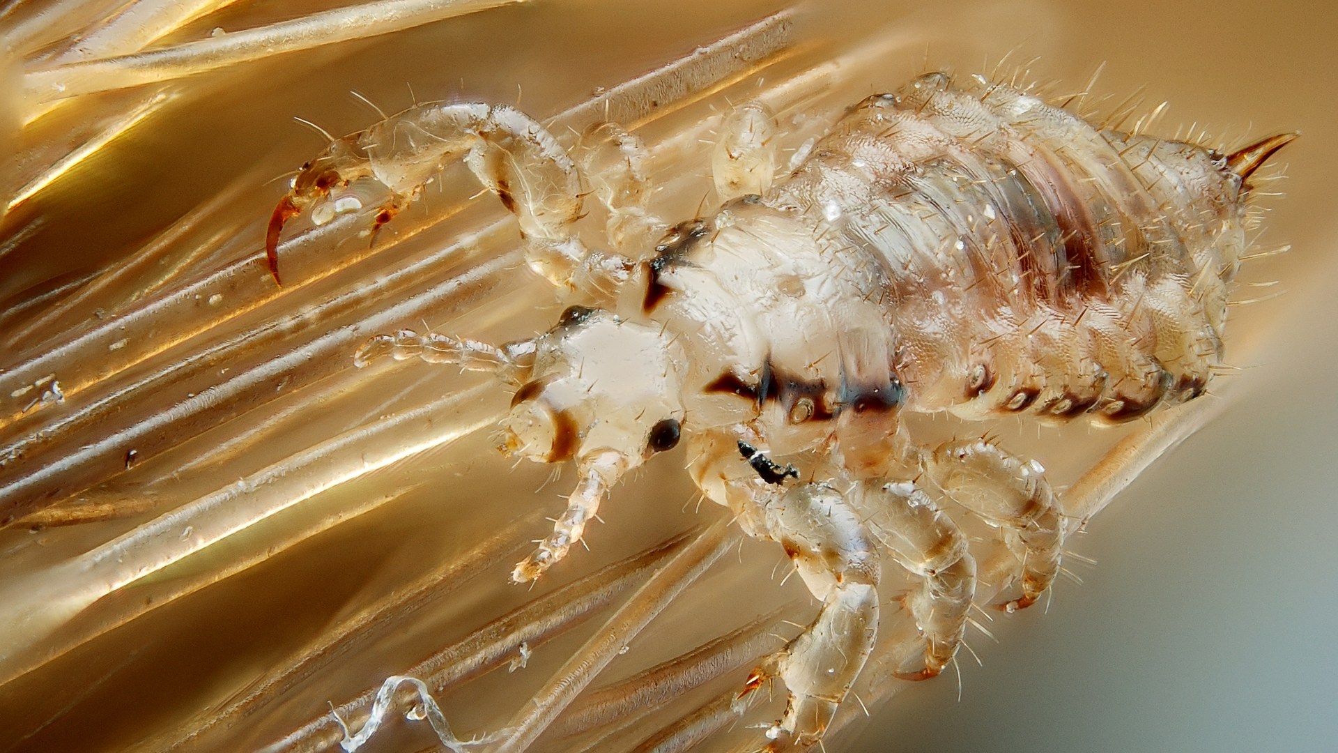 Paediatrician's Approach Tackles Head Lice While Combating Social Stigma